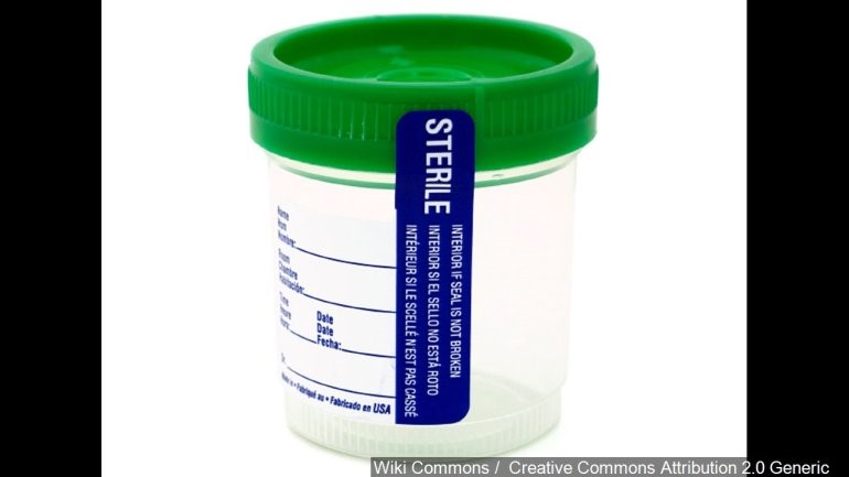 Synthetic Urine Cleaner 
      Kit Grand View Grand Junction CO
